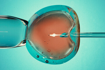 Ovum with needle and sperm for artificial insemination or in vitro fertilization. Concept of...