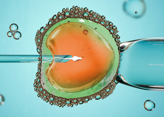 Ovum with needle and sperm for artificial insemination or in vitro fertilization. Concept of...