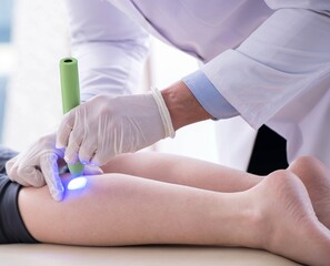 Patient in clinic undergoing laser scar removal