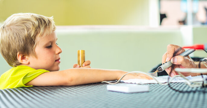 Vegetative rezonans diagnostic. Doctor examines child boy hand with the help of bioresonance dipstick tester, reveal disease causing bacteria via electromagnetic fields based on biofeedback principle