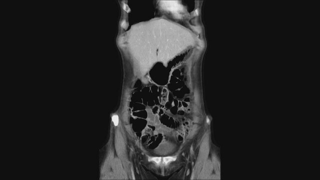 MRI of the female pelvic organs, abdominal cavity, gastrointestinal tract and bladder