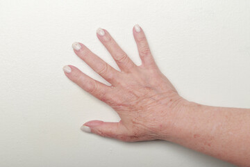 mano de mujer mayor con arrugas y uñas con el esmalte dañado