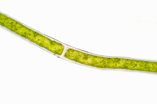 Microscopic view of green algae
