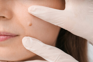 Dermatologist examining patient in clinic, closeup
