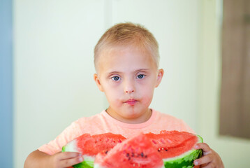 Little cute boy with Down Syndrome eating watermelon, disabled children, caring for sick people,...