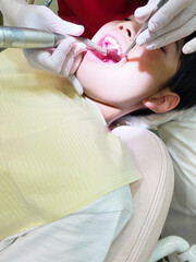 歯医者で歯石取りをする子供