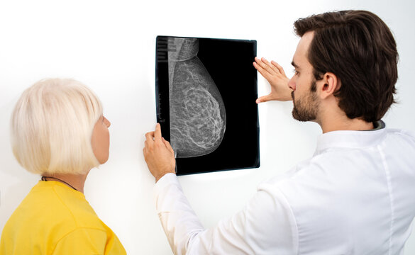 Mammogram film image of a female breast. Oncologist and an elderly patient are looking at the results of a breast x-ray. Diagnosis and prevention of breast cancer
