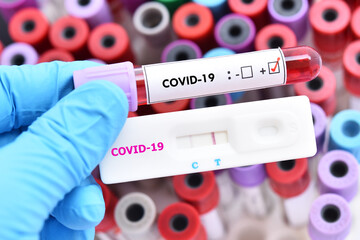 Obraz premium Positive test result by using rapid test device for COVID-19 virus, novel coronavirus pandemic disease in 2020