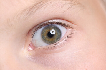 Wide open child's eye with an eyebrow and moles on skin. Visual examination in children