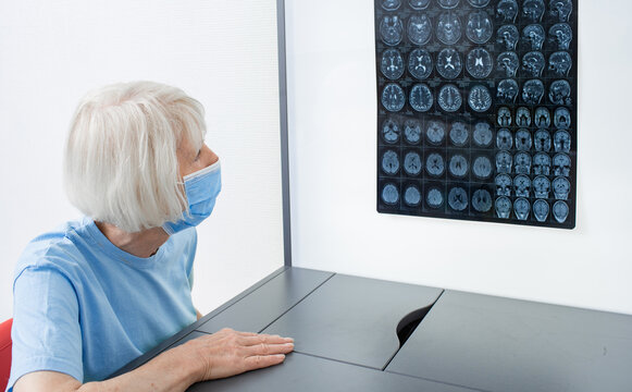Elderly woman patient wearing a medical mask looks at the results of an MRI scan of her brain. Diagnosis of diseases and head injuries. DIAGNOSTICS OF HEAD TUMOR