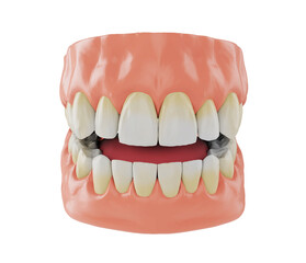 human jaw with yellowish teeth near the gums, correct bite, 3d render
