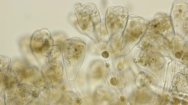 Infusoria Vorticella under the microscope, class Oligohymenophorea. Sample found at Lake Baikal