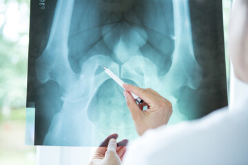 Doctor analyzing patients x-ray.