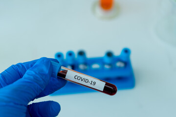 test tube containing blood sample infection from flu disease tested in medical science laboratory