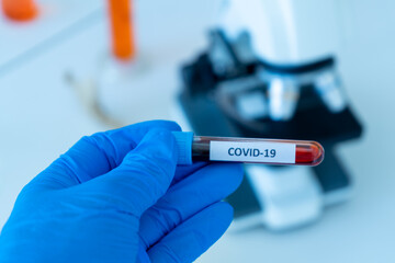 test tube containing blood sample infection from flu disease tested in medical science laboratory
