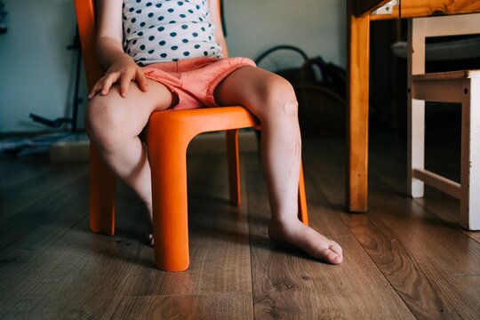 stock photo of toddler with a bandage on her knee