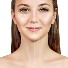 Female face before and after plastic surgery anti wrinkle.