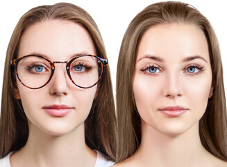 Young woman takes off glasses after sugery.