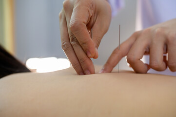 acupuncture young women.