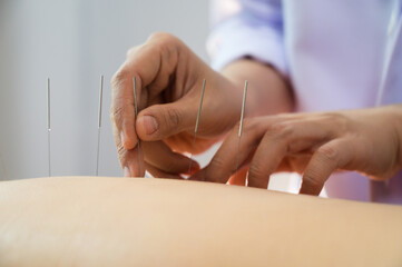 acupuncture young women.