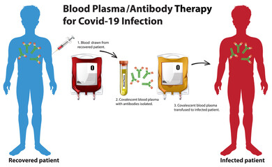 Blood Plasma/Antibody Therapy for Covid-19 Infection infographic