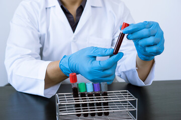 Male doctors are working with blood samples in the laboratory to check for infections in the blood.