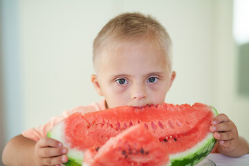 Little cute boy with Down Syndrome eating watermelon, disabled children, caring for sick people,...