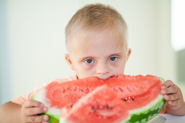 Little cute boy with Down Syndrome eating watermelon, disabled children, caring for sick people,...