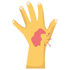 Hand Bleeding 