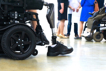 Plakat A man with a prosthetic leg in an electric wheelchair on the background of the medical staff. Rehabilitation of people with disabilities. Cropped frame. No face.
