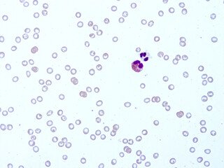 Histology of human tissue, show  epithelial tissue and connective tissue with microscope view  from laboratory (not Illustration Designation)