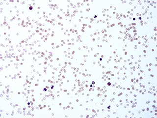 Histology of human tissue, show  epithelial tissue and connective tissue with microscope view  from laboratory (not Illustration Designation)