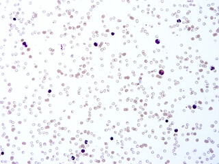 Histology of human tissue, show  epithelial tissue and connective tissue with microscope view  from laboratory (not Illustration Designation)