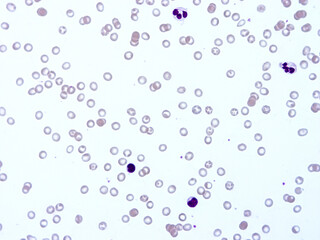 Histology of human tissue, show  epithelial tissue and connective tissue with microscope view  from laboratory (not Illustration Designation)