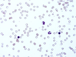Histology of human tissue, show  epithelial tissue and connective tissue with microscope view  from laboratory (not Illustration Designation)