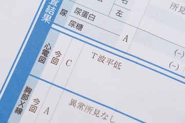 健康診断の結果　心電図の異常