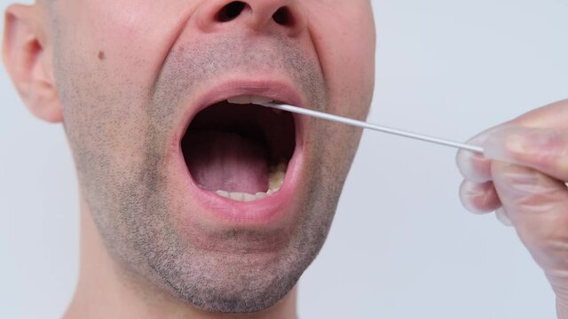 lab assistant takes a man’s saliva sample from his mouth for DNA analysis, open mouth close-up, concept of police investigation, medical examination, paternity