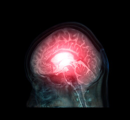 transparent image of the Skull  with  Brain for medical background concept.