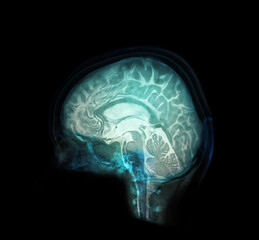 transparent image of the Skull  with  Brain for medical background concept.