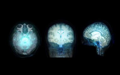 transparent image of the Skull  with  Brain for medical background concept.