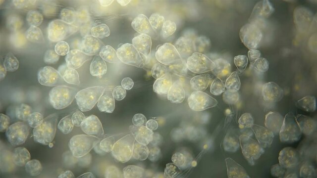 Infusoria Vorticella under the microscope, class Oligohymenophorea. Sample found at Lake Baikal