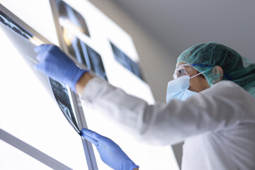 Female doctor looks at x-ray of patient in operating room. Working as doctor during pandemic covid...