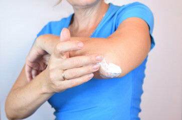 A woman smears ointment on the elbow of her left hand