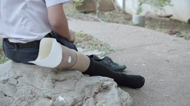 Slow motion of male high school disabled student in a white school uniform, black socks and black leather shoes with prosthetic legs is sitting in a park.