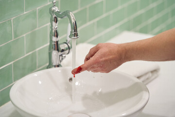 Bleeding blood from the cut finger, close-up.