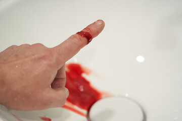 Bleeding blood from the cut finger, close-up.