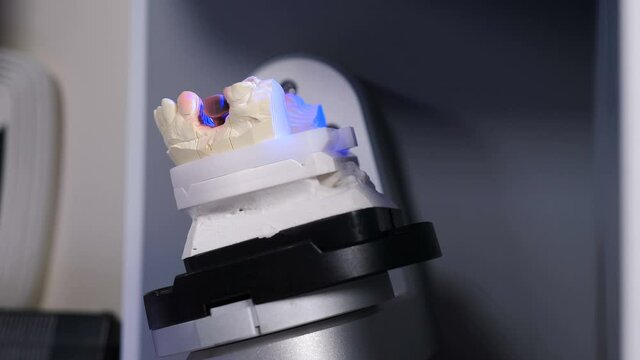 Dental technician scanning dental cast model in 3D surface scanners. Gypsum jaw model with implant being scanned inside dental 3D scanner. Changing position during process. 4 k video
