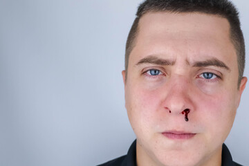 The man's nose started bleeding. High blood pressure caused blood vessels to rupture. A thin red...