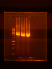 result of agarose gel electrophoresis of PCR products. separation of DNA fragments amplified with the PCR is used for genotyping of transgenic lines in search for heterozygeous lines with tDNA insert