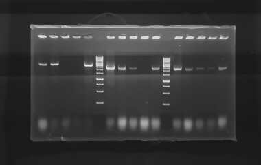 result of agarose gel electrophoresis of PCR products. separation of DNA fragments amplified with the PCR is used for genotyping of transgenic lines in search for heterozygeous lines with tDNA insert